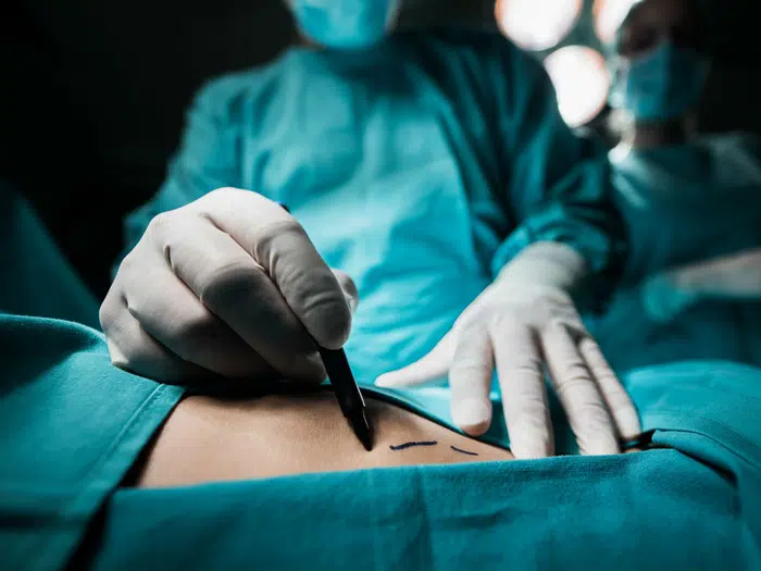 Surgical weight loss programs in Tampa, showcasing various types of procedures such as gastric bypass, gastric sleeve, and more.